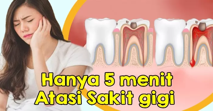 7 Tips Efektif Atas Sakit Gigi yang Luar Biasa, Nomor 1 Simpel Pakai Bahan yang Ada di Dapur